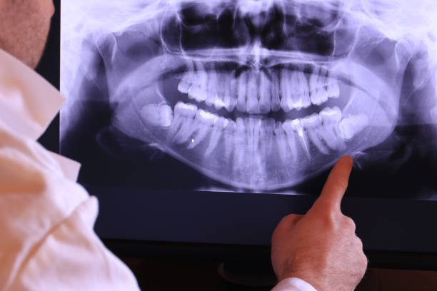 Best Emergency Treatment for Jaw Pain or Injury in Bloomington, CA